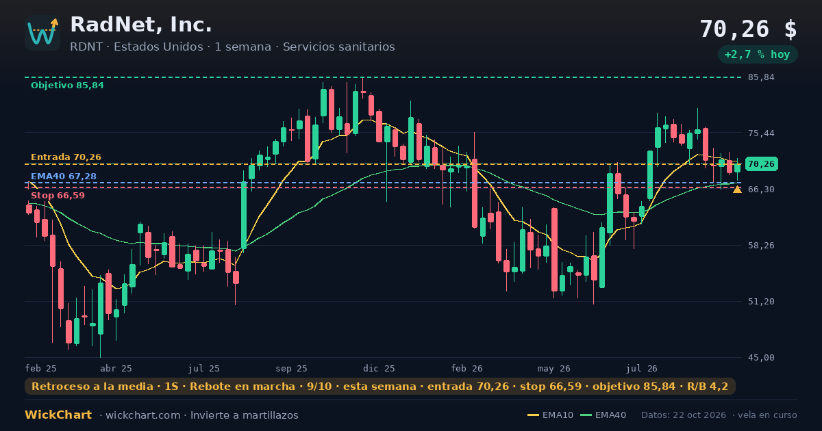 Gráfico de RadNet, Inc. (RDNT) con la señal destacada